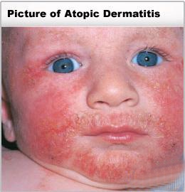 information about the perfect skin diet for healthy skin and better skin with a better diet healthy   living tips and more